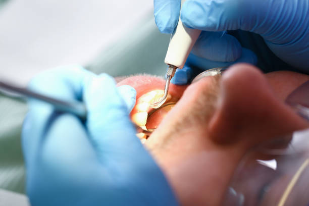 Best Emergency Gum Treatment in Wimberley, TX